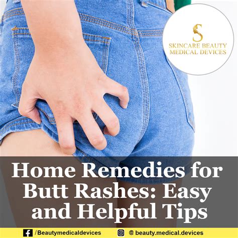 drying the anal area by dabbing, not rubbing. . Itching between buttocks home remedies